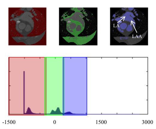 Figure 26